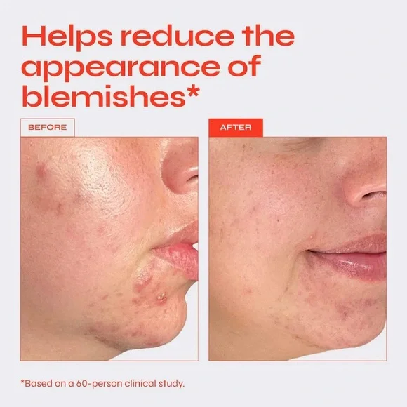 Brand New- Facile x Sephora Skincare Set ❤️✨ - Picture 6 of 13